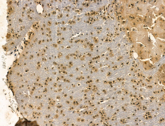 SRSF2 Antibody in Immunohistochemistry (Paraffin) (IHC (P))