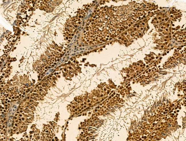 SRSF2 Antibody in Immunohistochemistry (Paraffin) (IHC (P))