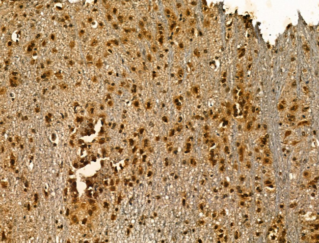 SRSF2 Antibody in Immunohistochemistry (Paraffin) (IHC (P))