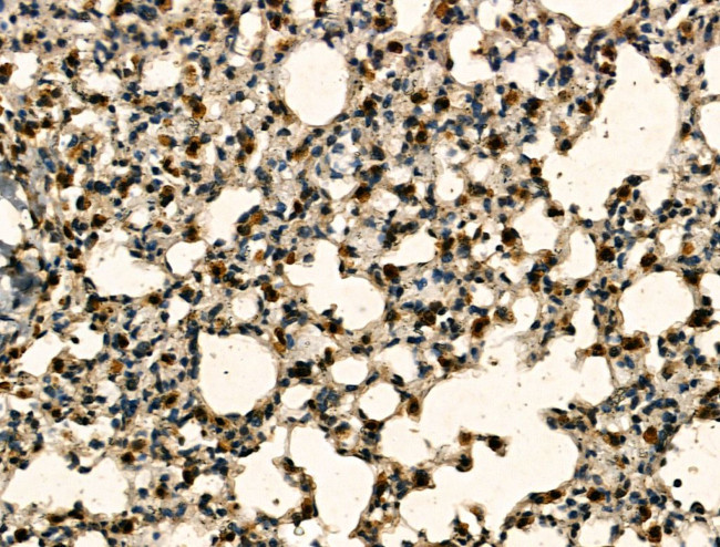 SRSF2 Antibody in Immunohistochemistry (Paraffin) (IHC (P))