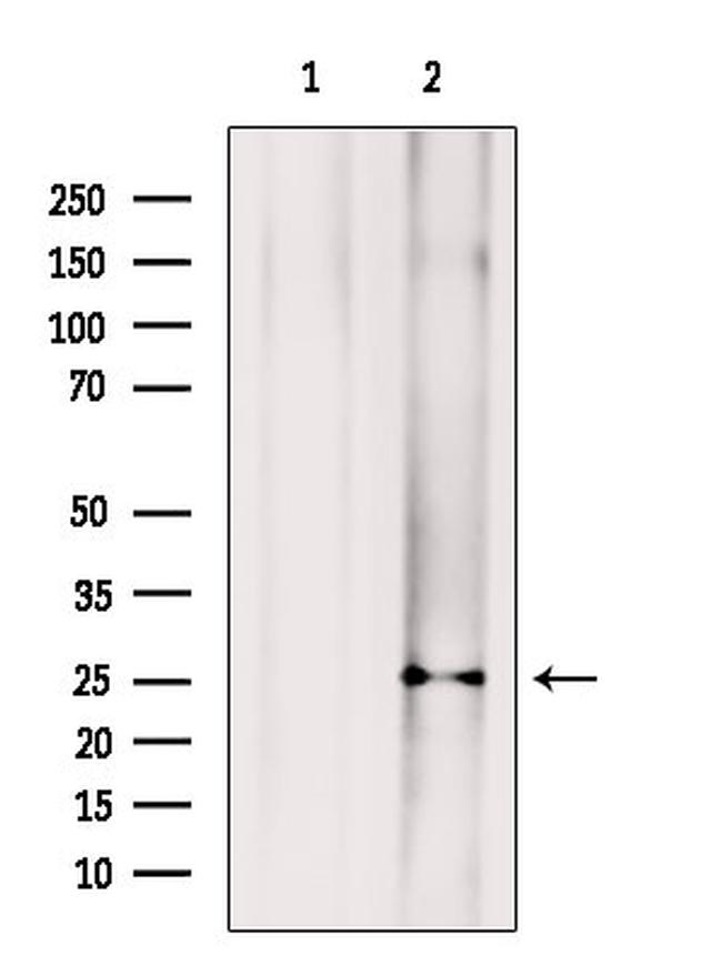 SRSF2 Antibody in Western Blot (WB)