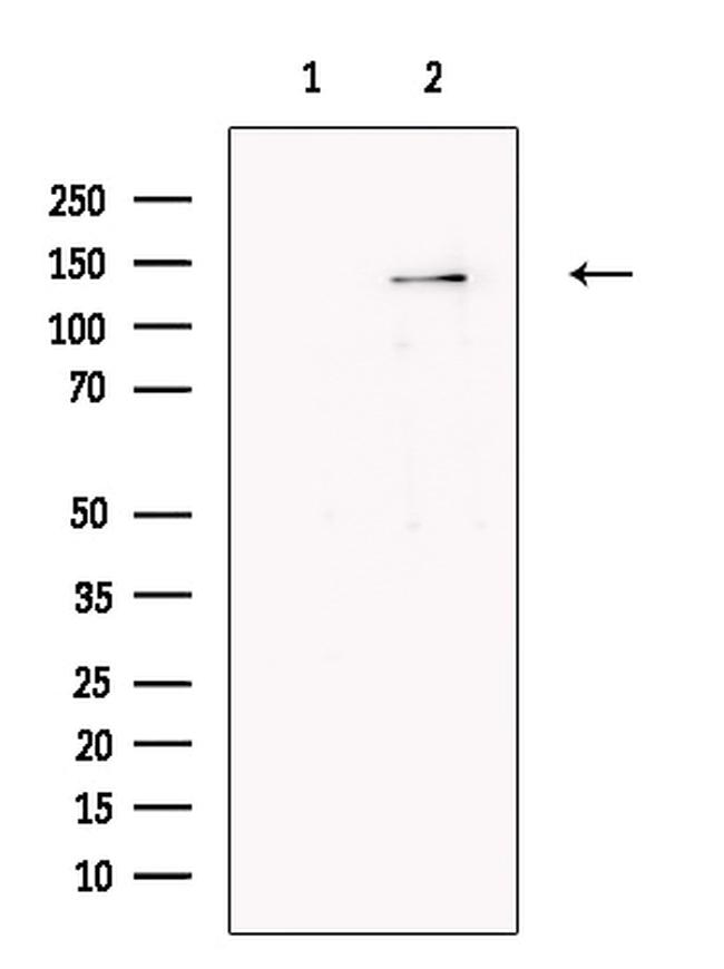 SCAP Antibody in Western Blot (WB)