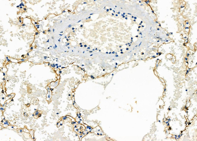 SCARF1 Antibody in Immunohistochemistry (Paraffin) (IHC (P))