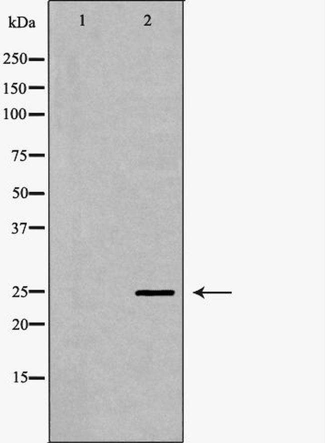 SCN4B Antibody in Western Blot (WB)