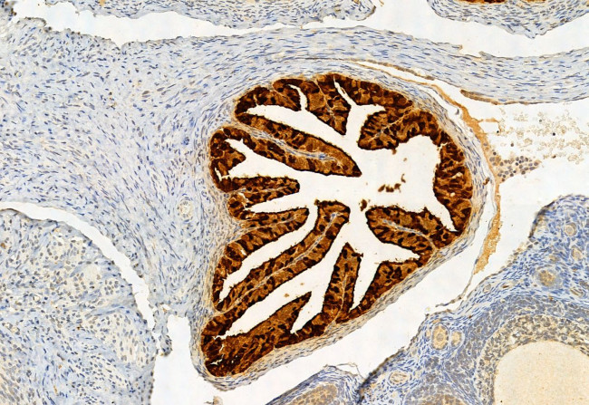 SESN2 Antibody in Immunohistochemistry (Paraffin) (IHC (P))