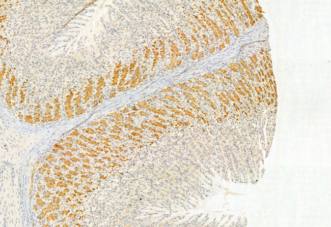 SESN2 Antibody in Immunohistochemistry (Paraffin) (IHC (P))