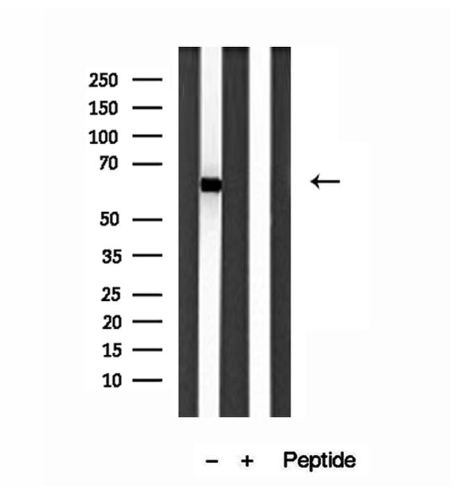 SESN2 Antibody in Western Blot (WB)