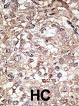 TLR1 Antibody in Immunohistochemistry (Paraffin) (IHC (P))