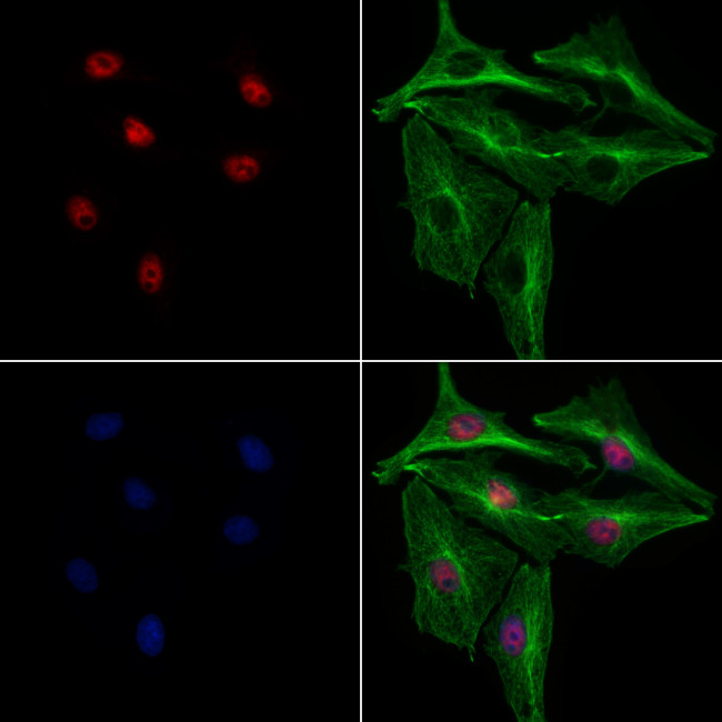 SGTA Antibody in Immunocytochemistry (ICC/IF)