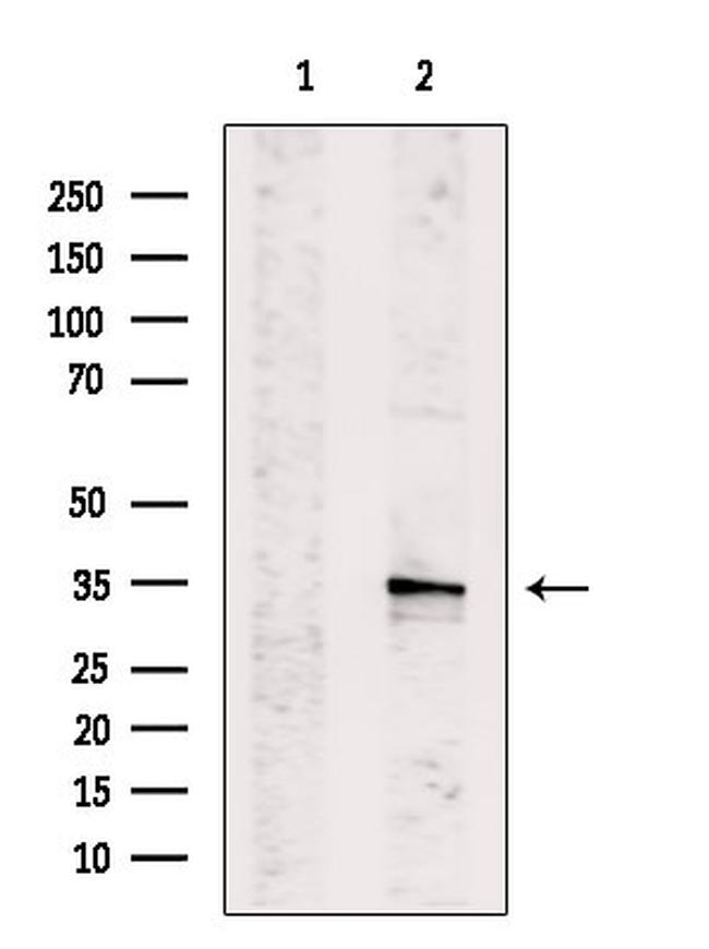 SGTA Antibody in Western Blot (WB)