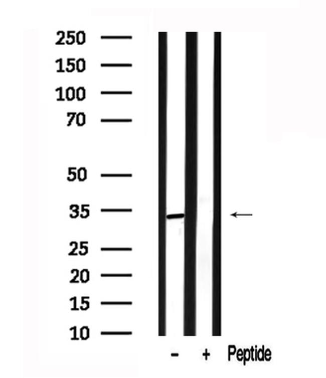 SGTA Antibody in Western Blot (WB)