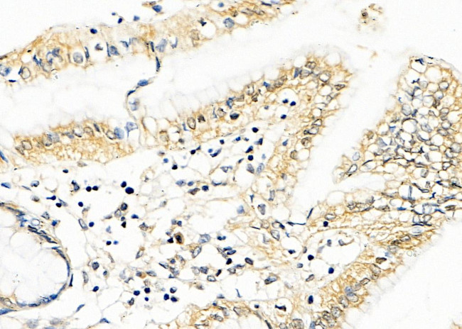 SH2D4A Antibody in Immunohistochemistry (Paraffin) (IHC (P))