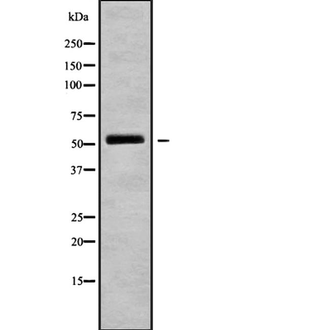 SH2D4A Antibody in Western Blot (WB)