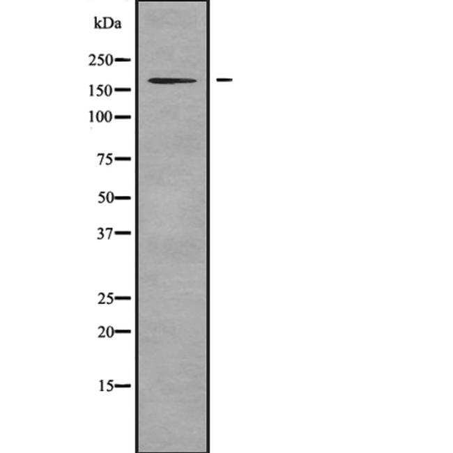 SHANK3 Antibody in Western Blot (WB)