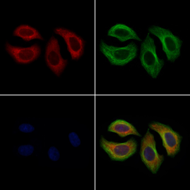 SHIP1 Antibody in Immunocytochemistry (ICC/IF)