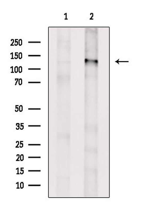 SHIP1 Antibody in Western Blot (WB)