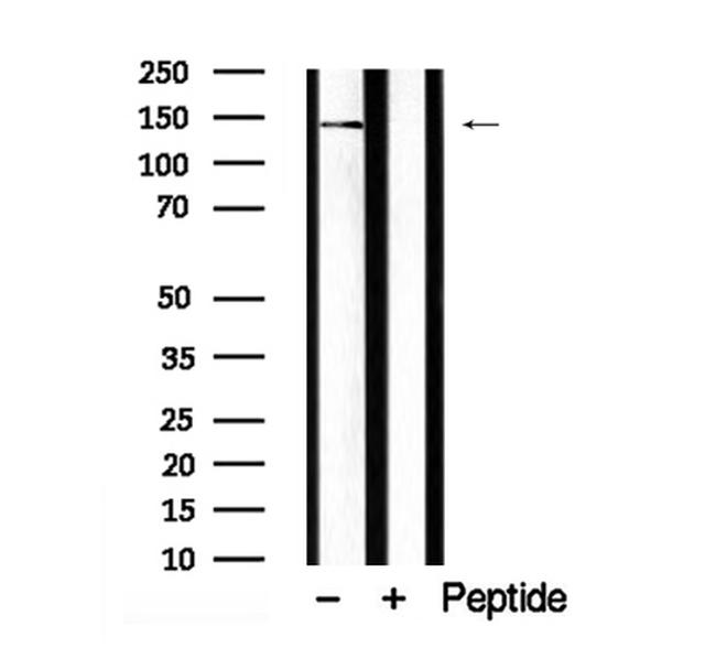 SHIP1 Antibody in Western Blot (WB)