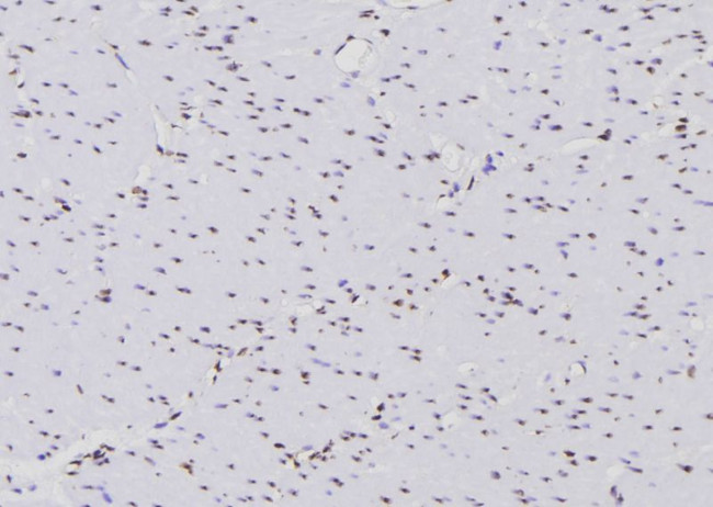 SHP-1 Antibody in Immunohistochemistry (Paraffin) (IHC (P))