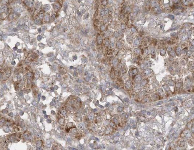 SIRT3 Antibody in Immunohistochemistry (Paraffin) (IHC (P))