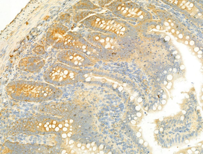 SIRT3 Antibody in Immunohistochemistry (Paraffin) (IHC (P))