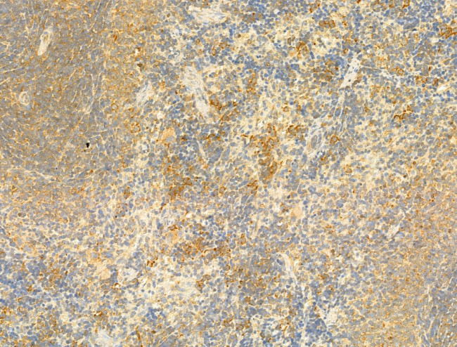 SIRT3 Antibody in Immunohistochemistry (Paraffin) (IHC (P))