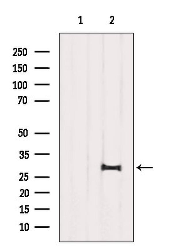 SIRT3 Antibody in Western Blot (WB)