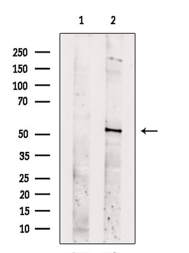 SLC16A8 Antibody in Western Blot (WB)