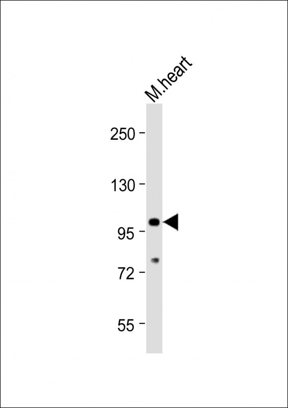 TLR2 Antibody in Western Blot (WB)