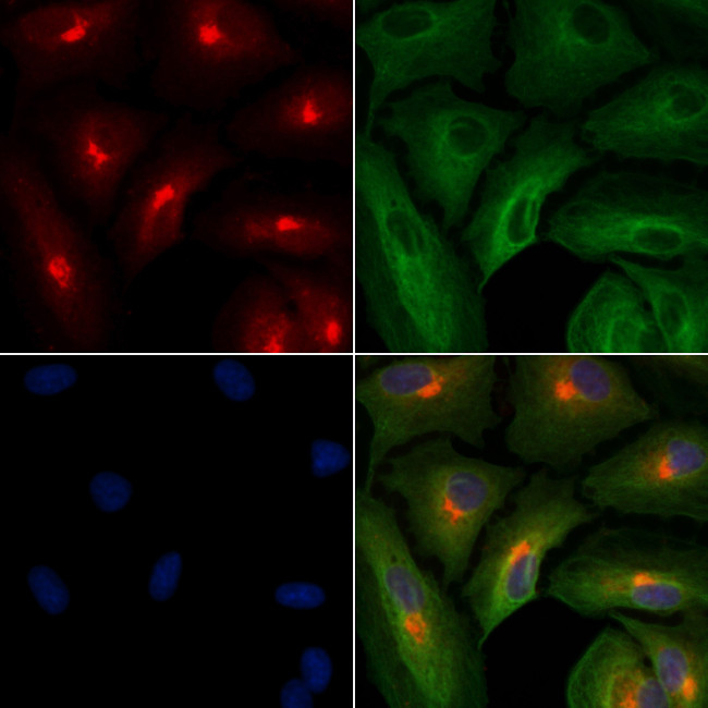 SLIT2 Antibody in Immunocytochemistry (ICC/IF)