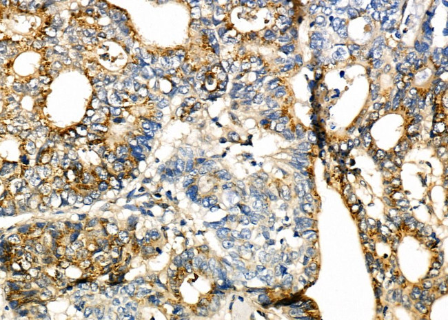 SLIT2 Antibody in Immunohistochemistry (Paraffin) (IHC (P))