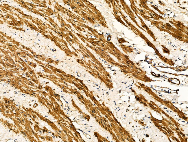 TAGLN Antibody in Immunohistochemistry (Paraffin) (IHC (P))