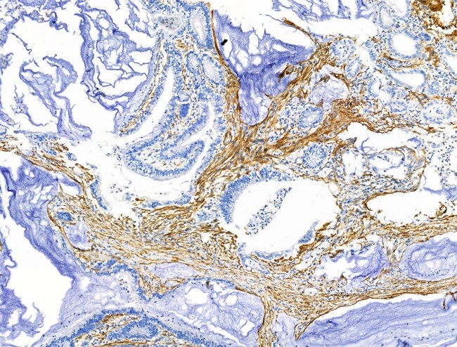 TAGLN Antibody in Immunohistochemistry (Paraffin) (IHC (P))