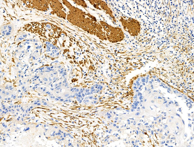 TAGLN Antibody in Immunohistochemistry (Paraffin) (IHC (P))