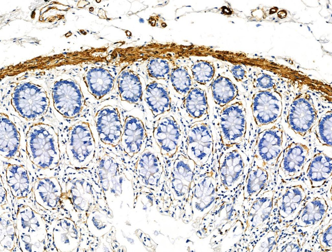 TAGLN Antibody in Immunohistochemistry (Paraffin) (IHC (P))