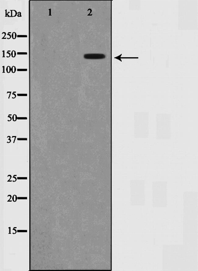 SMC1 Antibody in Western Blot (WB)