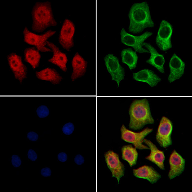 SMC1 Antibody in Immunocytochemistry (ICC/IF)