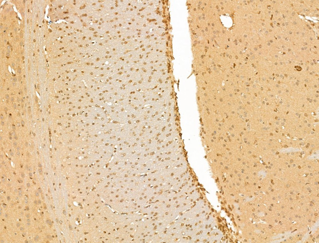 SMC2 Antibody in Immunohistochemistry (Paraffin) (IHC (P))