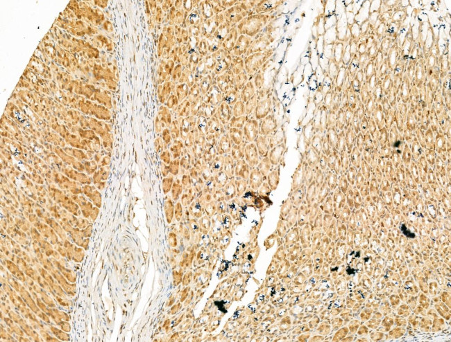 SMC2 Antibody in Immunohistochemistry (Paraffin) (IHC (P))