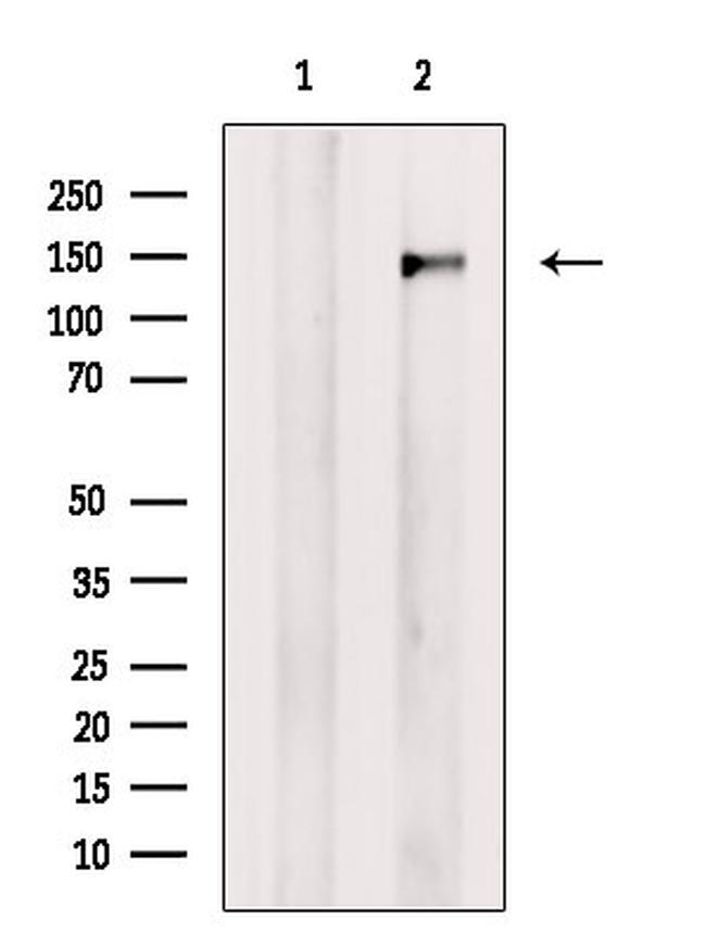 SMC2 Antibody in Western Blot (WB)