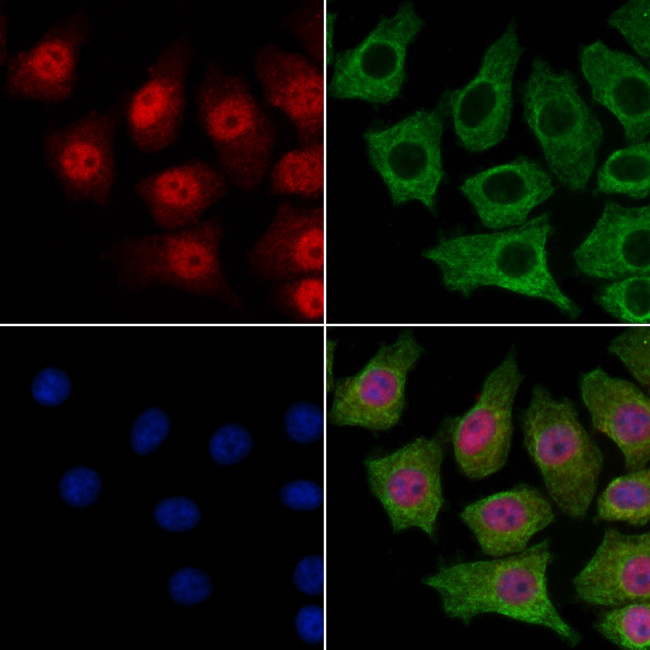 SMC5 Antibody in Immunocytochemistry (ICC/IF)