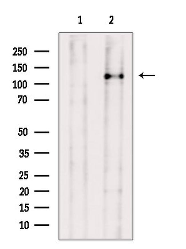 SMC5 Antibody in Western Blot (WB)