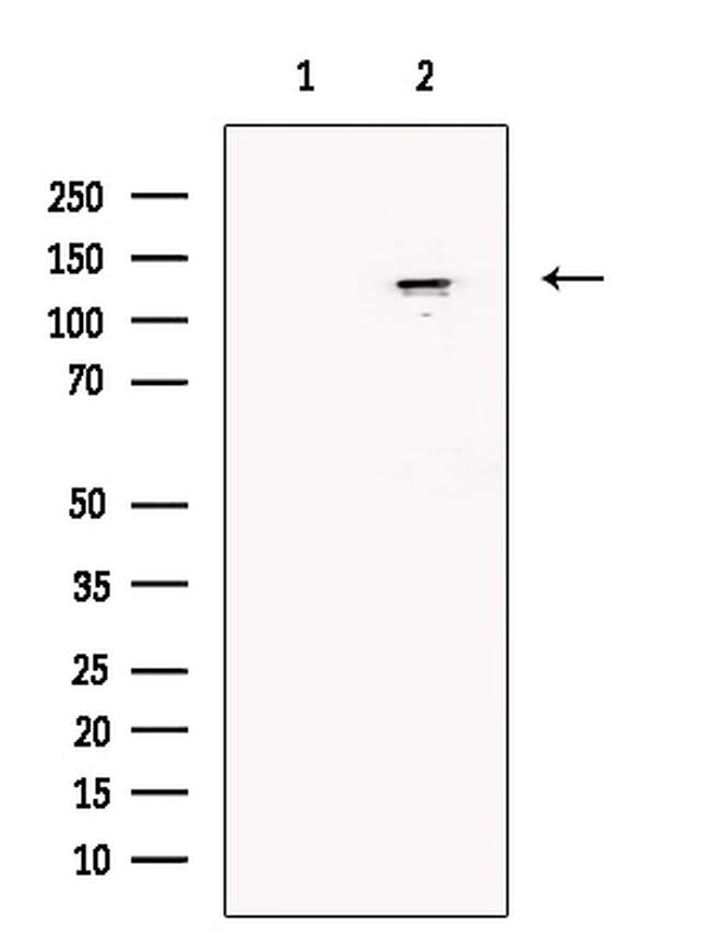 SMC5 Antibody in Western Blot (WB)