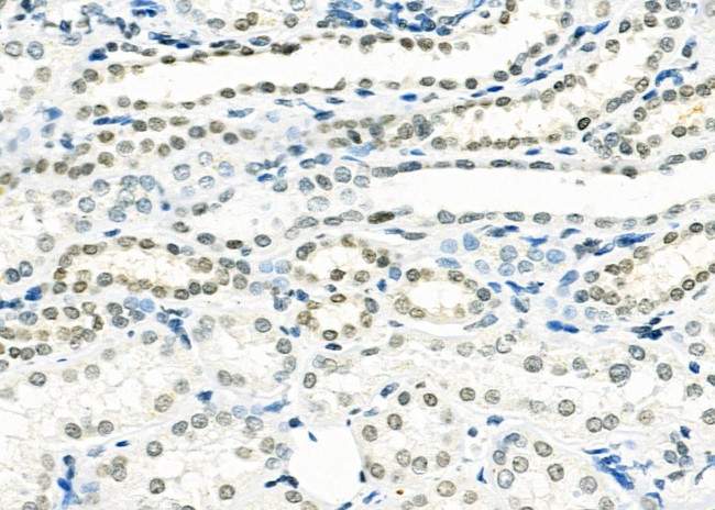 SMYD3 Antibody in Immunohistochemistry (Paraffin) (IHC (P))