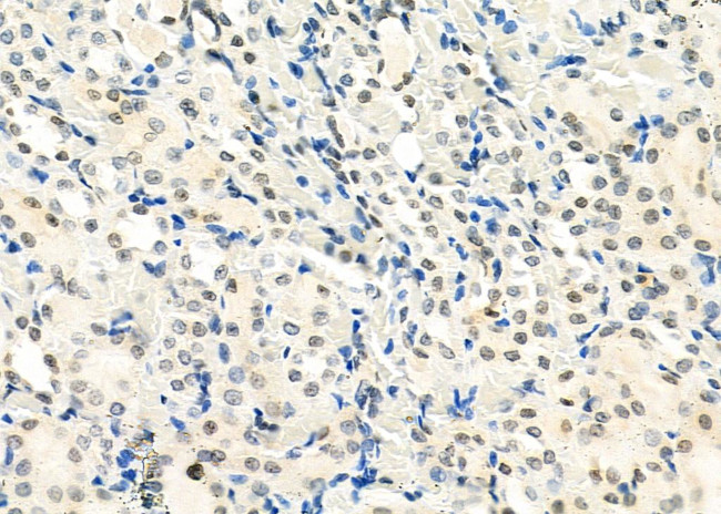 SMYD3 Antibody in Immunohistochemistry (Paraffin) (IHC (P))