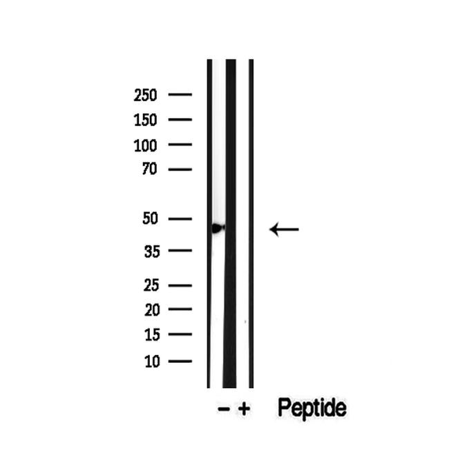 SMYD3 Antibody in Western Blot (WB)