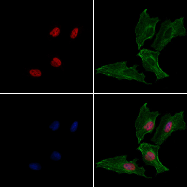 SNAIL Antibody in Immunocytochemistry (ICC/IF)