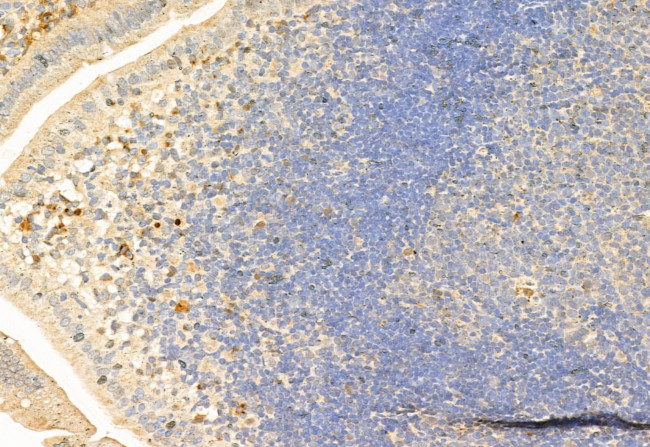 SNAIL Antibody in Immunohistochemistry (Paraffin) (IHC (P))