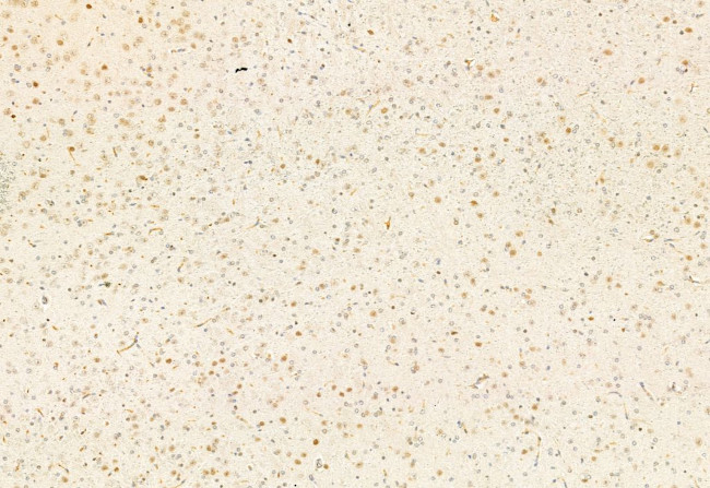 SNAIL Antibody in Immunohistochemistry (Paraffin) (IHC (P))