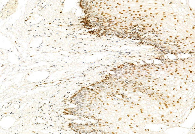 SNAIL Antibody in Immunohistochemistry (Paraffin) (IHC (P))