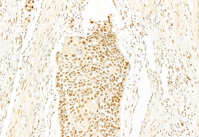 SNAIL Antibody in Immunohistochemistry (Paraffin) (IHC (P))